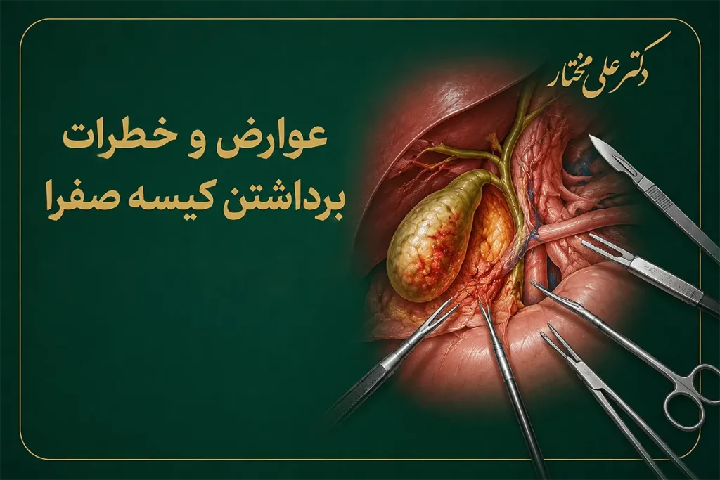 عوارض و خطرات برداشتن کیسه صفرا